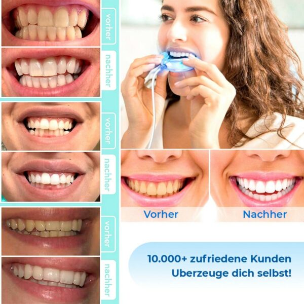 Zahnaufhellung Gel Stift für strahlend weiße Zähne - Teeth Whitening - Image 2