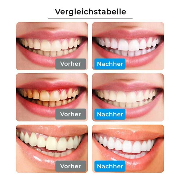 Zahnaufhellungsstift für strahlend weiße Zähne - Teeth Whitening Gel - Image 5