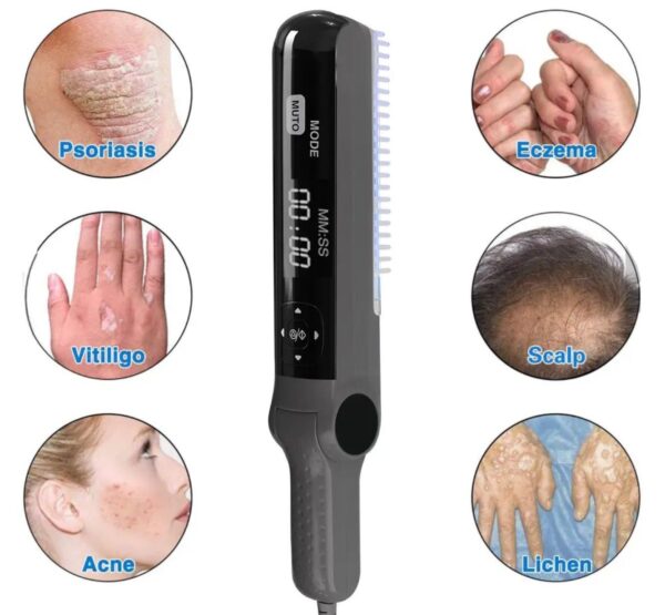 Lichttherapie UVB 311 nm Lampe für Hautprobleme mit Philips 9W01 Birne - Image 2
