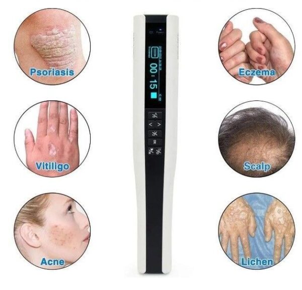 Kernel KN-4003BL2 UVB Lampe mit Ständer für Vitiligo, Ekzeme & Psoriasis - Image 1