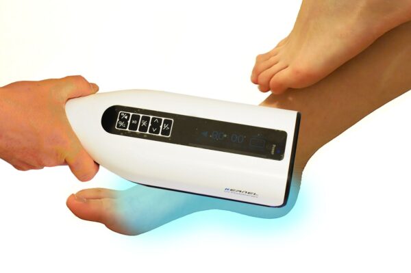 UVB Lampe für Schuppenflechte, Psoriasis, Vitiligo & Eczema Lichttherapie 311nm - Image 2