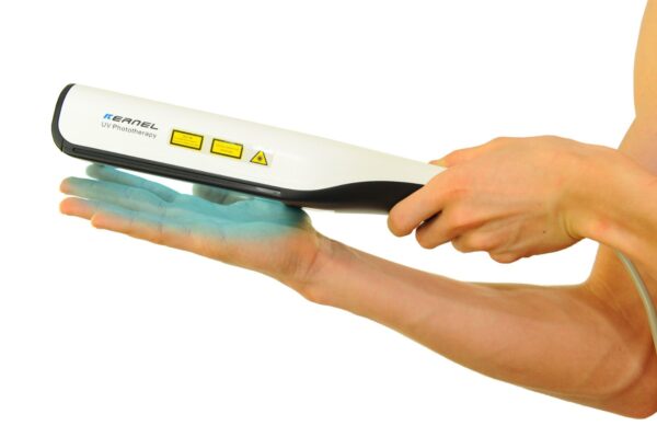 UVB Lampe für Schuppenflechte, Psoriasis, Vitiligo & Eczema Lichttherapie 311nm - Image 3
