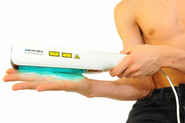 UVB Lampe für Schuppenflechte, Psoriasis, Vitiligo & Eczema Lichttherapie 311nm - Image 4