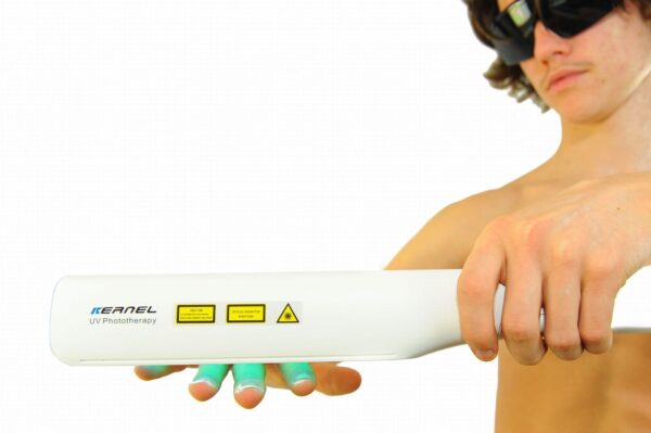 UVB Lampe für Schuppenflechte, Psoriasis, Vitiligo & Eczema Lichttherapie 311nm - Image 5