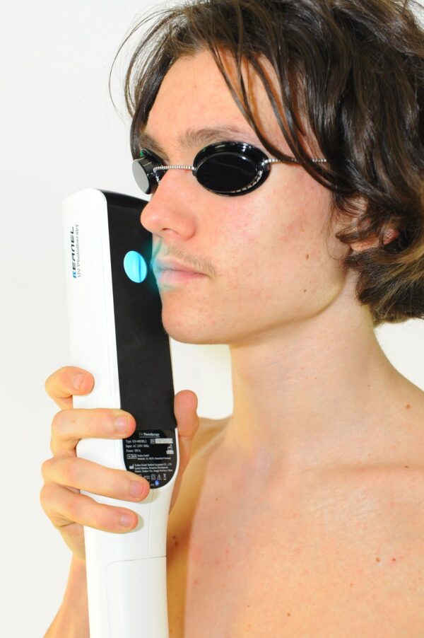 UVB 311nm Phototherapie Lampe für Akne, Psoriasis & Vitiligo mit Akku 9W - Image 2