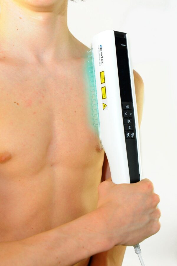UVB 311nm Phototherapie Lampe für Akne, Psoriasis & Vitiligo mit Akku 9W - Image 3