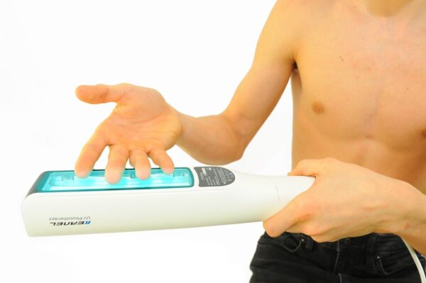 UVB 311nm Phototherapie Lampe für Akne, Psoriasis & Vitiligo mit Akku 9W - Image 4